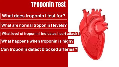 Management of Elevated Troponin I Levels in Adult Medical .